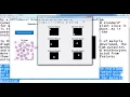 Detection of Malaria Parasites matlab projects Detection of Malaria Parasites matlab thesis