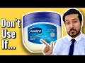 Vaseline on Face Watch FIRST Before Using