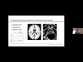 Application of Machine Learning to Prostate Cancer and Urology