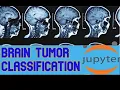 Brain Tumor Classification Using Convolution Neural Network with Augmentation