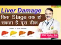 Download Lagu Liver Damage किस Stage तक हो सकता है पूरा ठीक || VISUAL GUIDE TO LIVER PROBLEMS THE SYMPTOMS