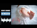 Newborn heart beat sound How to calculate NB Heart rate Normal NB Heart sound Christina NP