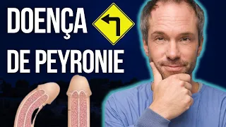 COMO CONSERTAR O PENIS TORTO (Pt 1): TRATAMENTOS SEM CIRURGIA DA DOENÇA DE PEYRONIE