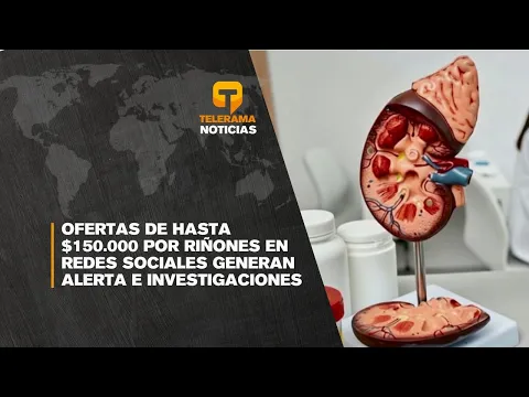 Ofertas de hasta $150.000 por riñones en redes sociales generan alerta e investigaciones