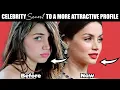 Chin Filler Before After - Celebrity Secret to an Attractive Profile