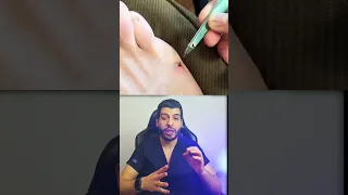 التهاب جلدي التهاب الالتهابات جلدية جلد تعقيم جرح جروح د مصعب حسوا ثقف نفسك طبيا  التهاب جلدي التهاب الالتهابات جلدية جلد تعقيم جرح جروح د مصعب حسوا ثقف نفسك طبيا