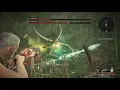 Remnant - Ixillis Apocalypse DareDevil s Charm BR
