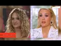 EXCLUSIVE Before and After - Carrie Underwood s Significant Filler Treatments Gives The American