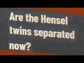 Are the Hensel twins separated now