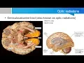 Neurosurgery written board crash course - visual cortex and visual processing