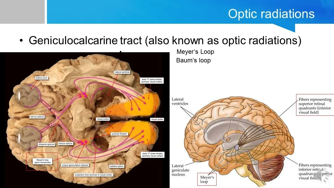 Neurosurgery written board crash course - visual cortex and visual processing