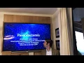 Parotidectomia