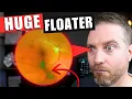 Lagu What Causes This Huge Eye Floater!? PVD Treatments Explained