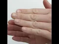 Bladder Expression