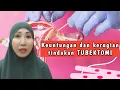 Download Lagu kamu mau tubektomi⁉️kenali KEUNTUNGAN dan KERUGIAN TUBEKTOMI