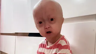 Gạo 1 cô bé hài hước và thông minh…!🥰 #tepgaofamily #family #begao #giadinh #BeGaoTiHon #funny