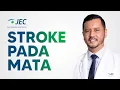 Lagu Stroke Pada Mata | Dr. Ferdiriva Hamzah, SpM(K)