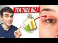 The TRUTH about Tea Tree Oil Good or Bad for your Eyes