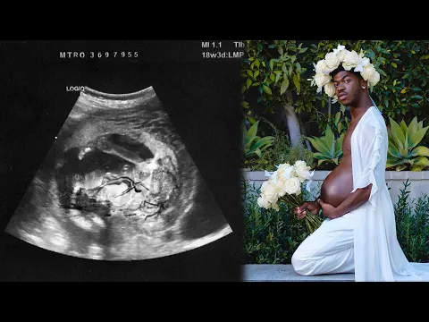 Download MP3 Lil Nas X Is PREGNANT?!