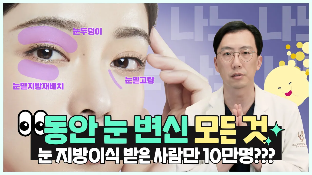 ⭐눈 지방이식은 【        】하게 해야돼요?! #성공적 #노하우 · 쌍수 안하고🙅🏻‍♀️🙅🏻‍♂️지방이식만 가능? #최문섭원장님 #그레이스성형외과  (ep.2)