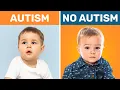 Download Lagu 10 Subtle Signs Of Autism Most Parents Miss