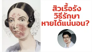 ถุงน้ำรังไข่สามารถทำให้เกิดสิวได้หรือไม่ และรักษาอย่างไร