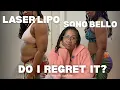 2 Month Laser Liposuction Update Pain Cost Honest Thoughts Before and After Photos