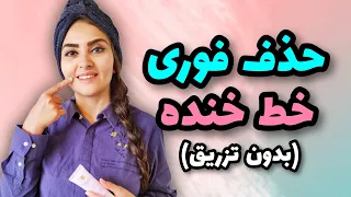 حذف و کاهش خط خنده لبخند با یوگای صورت خط خنده را چطور از بین ببریم 