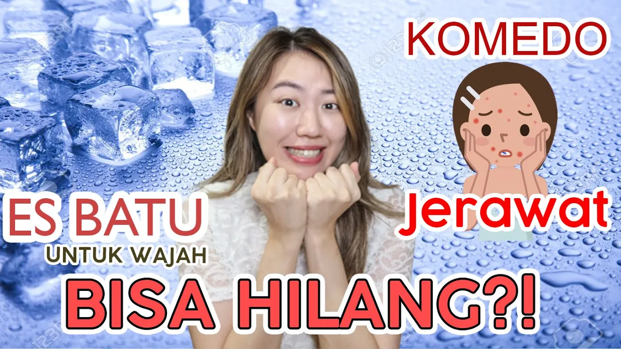 BEKAS JERAWAT HILANG DONG | DENGAN ES BATU - AMPUH!!. 