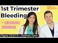 1st Trimester Bleeding and Subchorionic Hematoma SCH - Pregnant and Pediatrician Explain