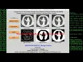 Lung Cancer Detection Using CNN Convolutional Neural Network Python OpenCV Tensorflow Project Code