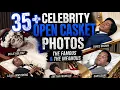 35 Celebrity Open Casket Photos - The Famous The Infamous Part 2