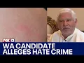 WA House candidate alleges hate crime in Mukilteo attack FOX 13 Seattle