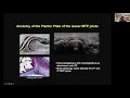 Forefoot with Dr Douglas Hoffman AMSSM Sports Ultrasound Case Presentation