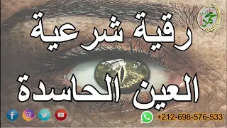 رقية مزلزة تبطل العين الحاسدة ولن يتحملها اي شيطان في جسدك اتحداك ان تكملها 