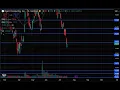 RGTI Stock Rigetti Computing stock RGTI STOCK PREDICTION RGTI STOCK analysis RGTI stock news today