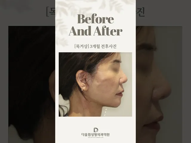 YouTube 영상