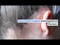 Swelling Behind the Ears Common Causes and When to Seek Medical Care BuoyHealth com