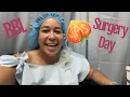 BBL Surgery Day Mia Aesthetics Las Vegas Cosmetic Surgery
