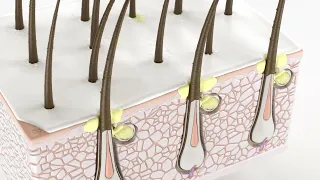 Schwarzkopf Professional  BC Anti-Dandruff Serum