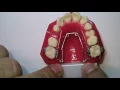 Wilson 3D Quad-Helix