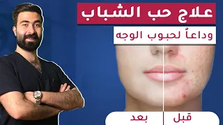 Eliminate Acne And Facial Bumps The Fastest Way Treat Acne In Just 5 Days 