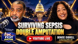 Surviving Sepsis and Double Amputation