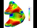 How to let SOLIDWORKS Simulation find the best design for you