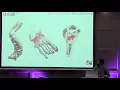 Pycon Ireland 2018 Patient Data Made Real - Lorenzo Trojan