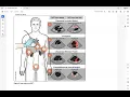 Emergency Mediciine Lecture