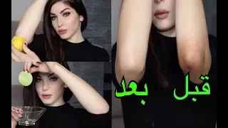 وصفة خارقة لتفتيح المناطق السوداء في الجسم ومن أول استعمال مضمونة و بدون مزح 