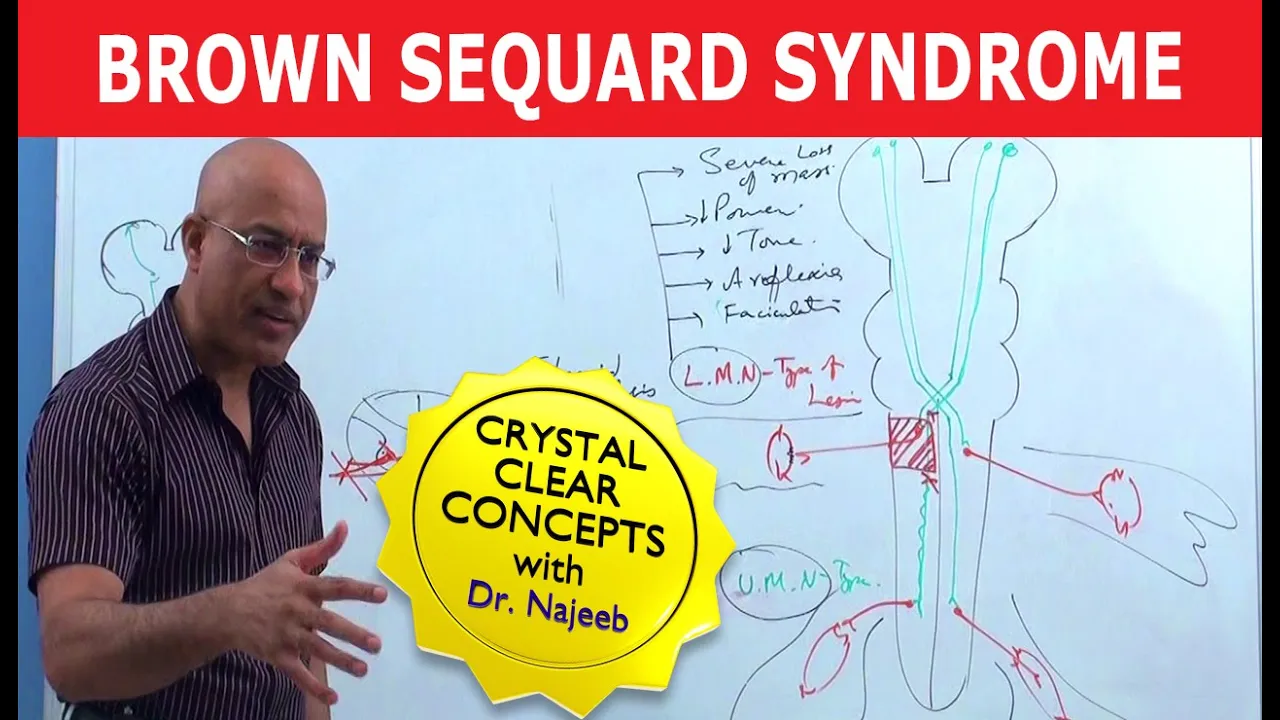 Brown Sequard Syndrome | Internal Medicine 💊