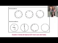 Clock Drawing Test