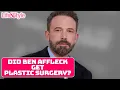 Did Ben Affleck Get Plastic Surgery Done Life Style News